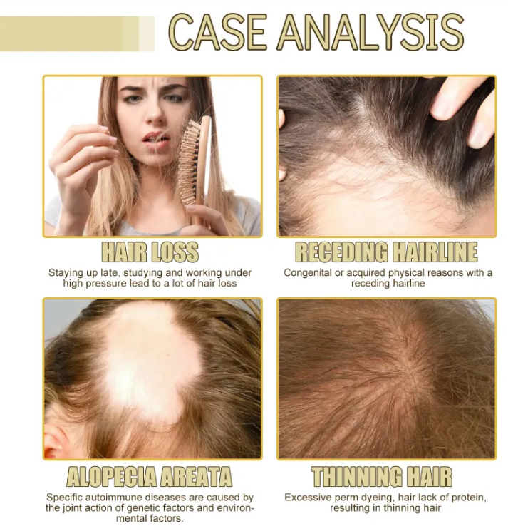 Rosemary Dense Hair Essential Oil – Scalp Nourishing Hair Growth Oil | Available in Sets of 1–6