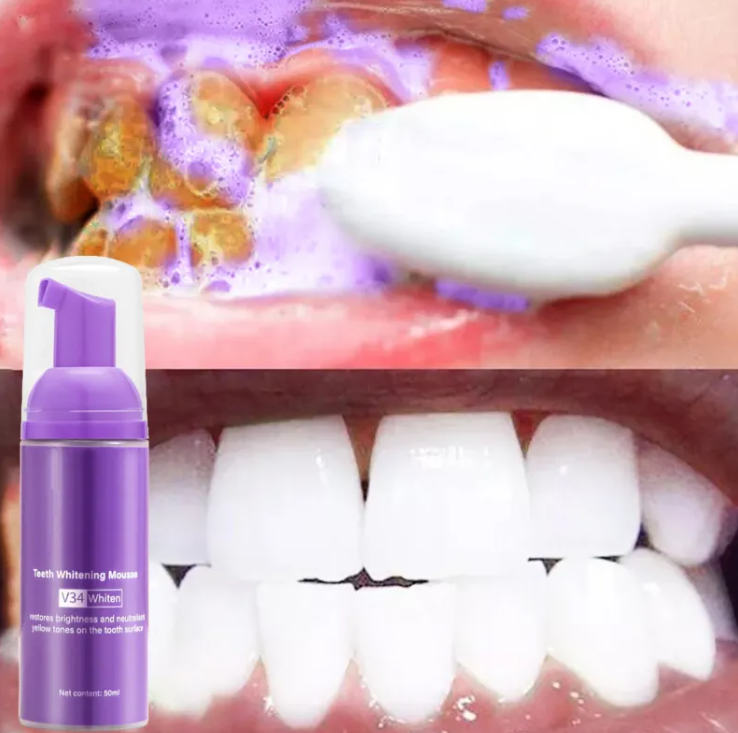 Smoke Stain Removal Teeth Whitening Mousse – Enamel-Safe Whitening & Stain-Lifting Foam for Smokers | 50ml