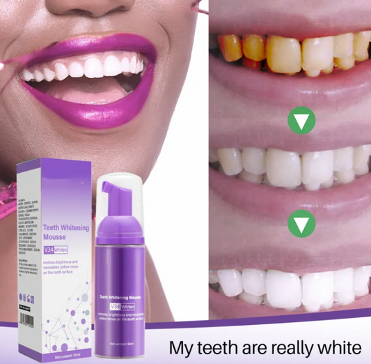 Smoke Stain Removal Teeth Whitening Mousse – Enamel-Safe Whitening & Stain-Lifting Foam for Smokers | 50ml