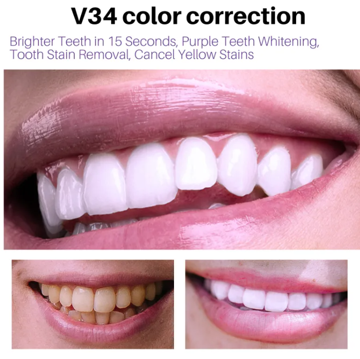 Smoke Stain Removal Teeth Whitening Mousse – Enamel-Safe Whitening & Stain-Lifting Foam for Smokers | 50ml
