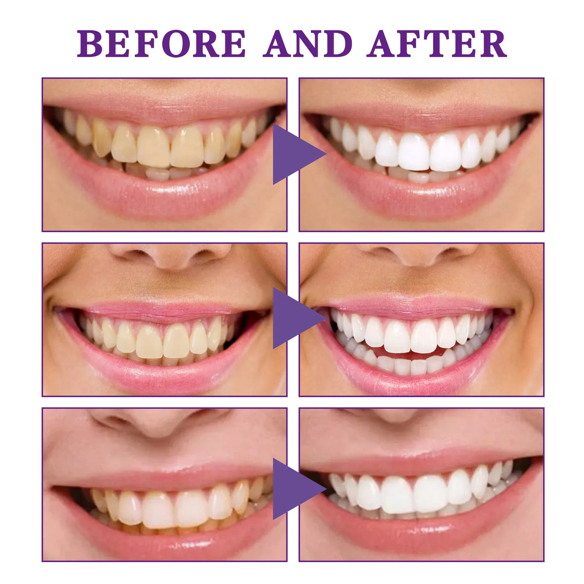 V34 Teeth Whitening Cleaning Mousse – Anti-Yellow, Gum Care & Fresh Breath Foam | 30ml | Solo or Set